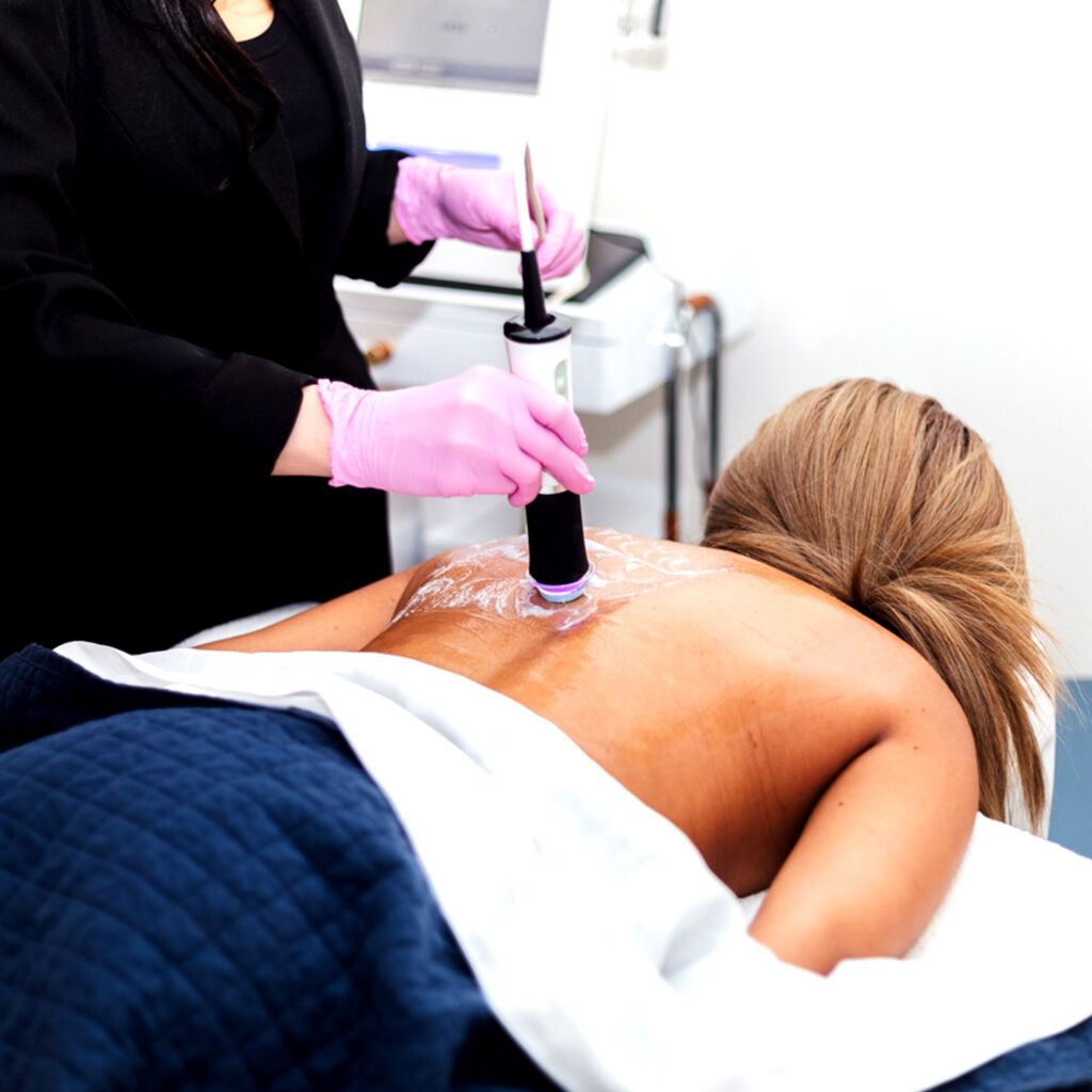 Glo2-back-facial-treatment-for-back-acne