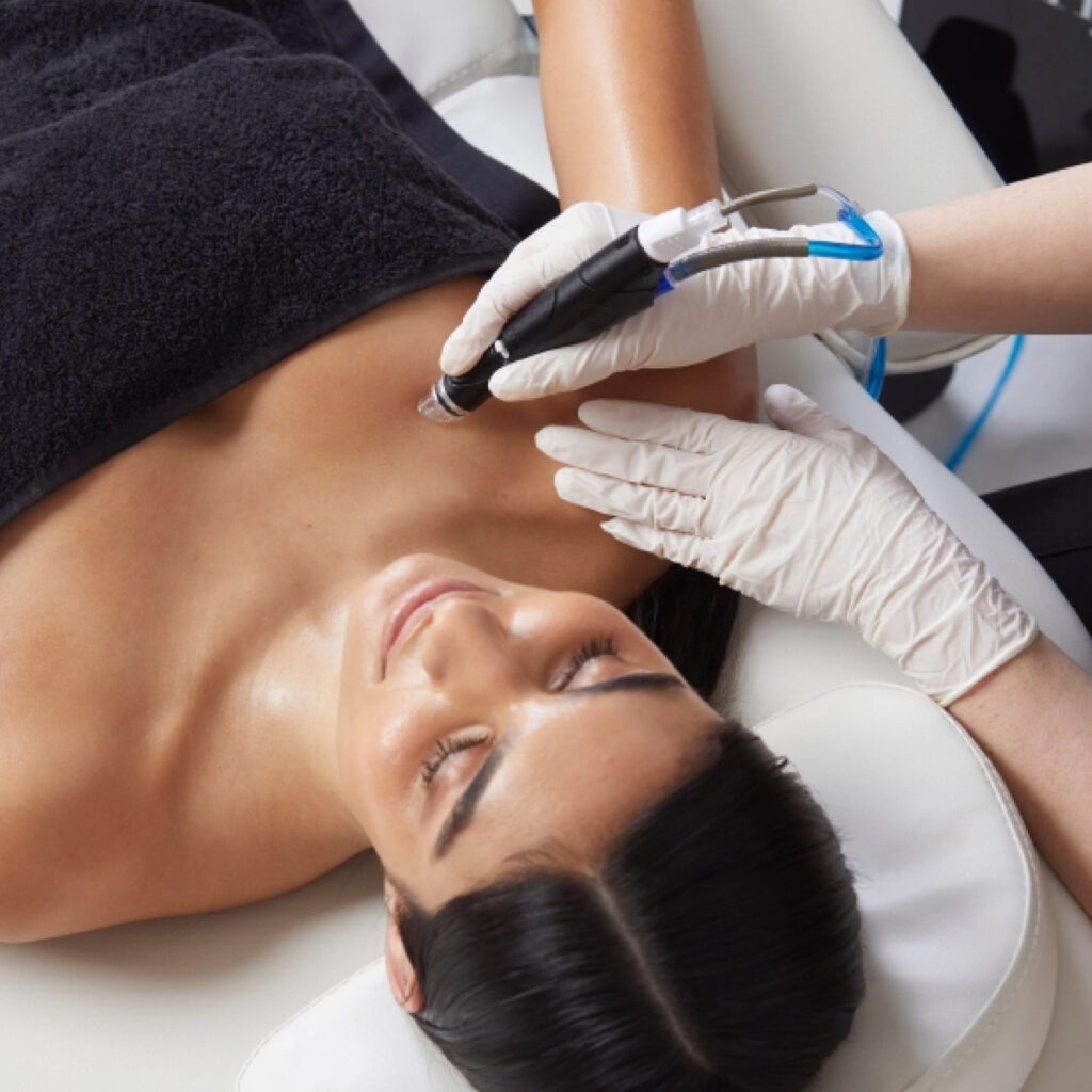 hydrafacial-Neck-Decollete