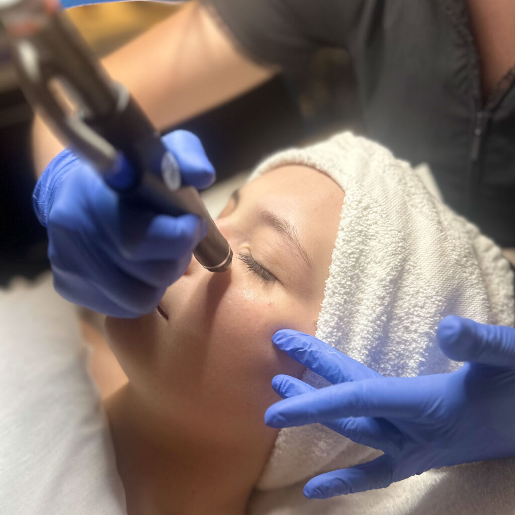 hydrafacial-perk-eye-treatment