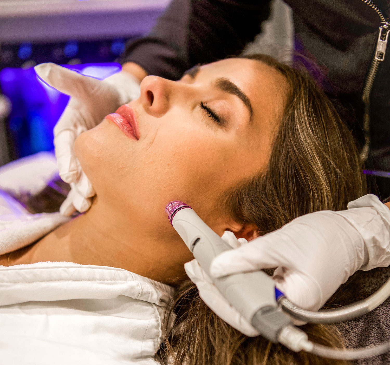 HydraFacial acne treatment at Rivage Day Spa Birmingham MI