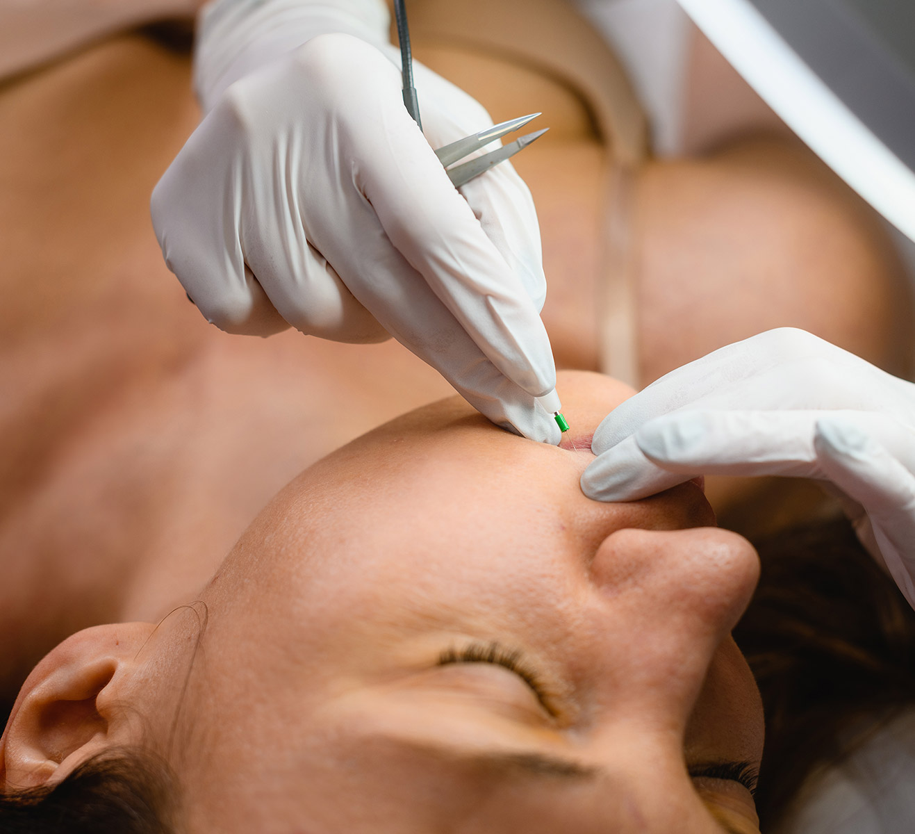 Electrolysis permanent hair removal at Rivage Day Spa, Birmingham MI